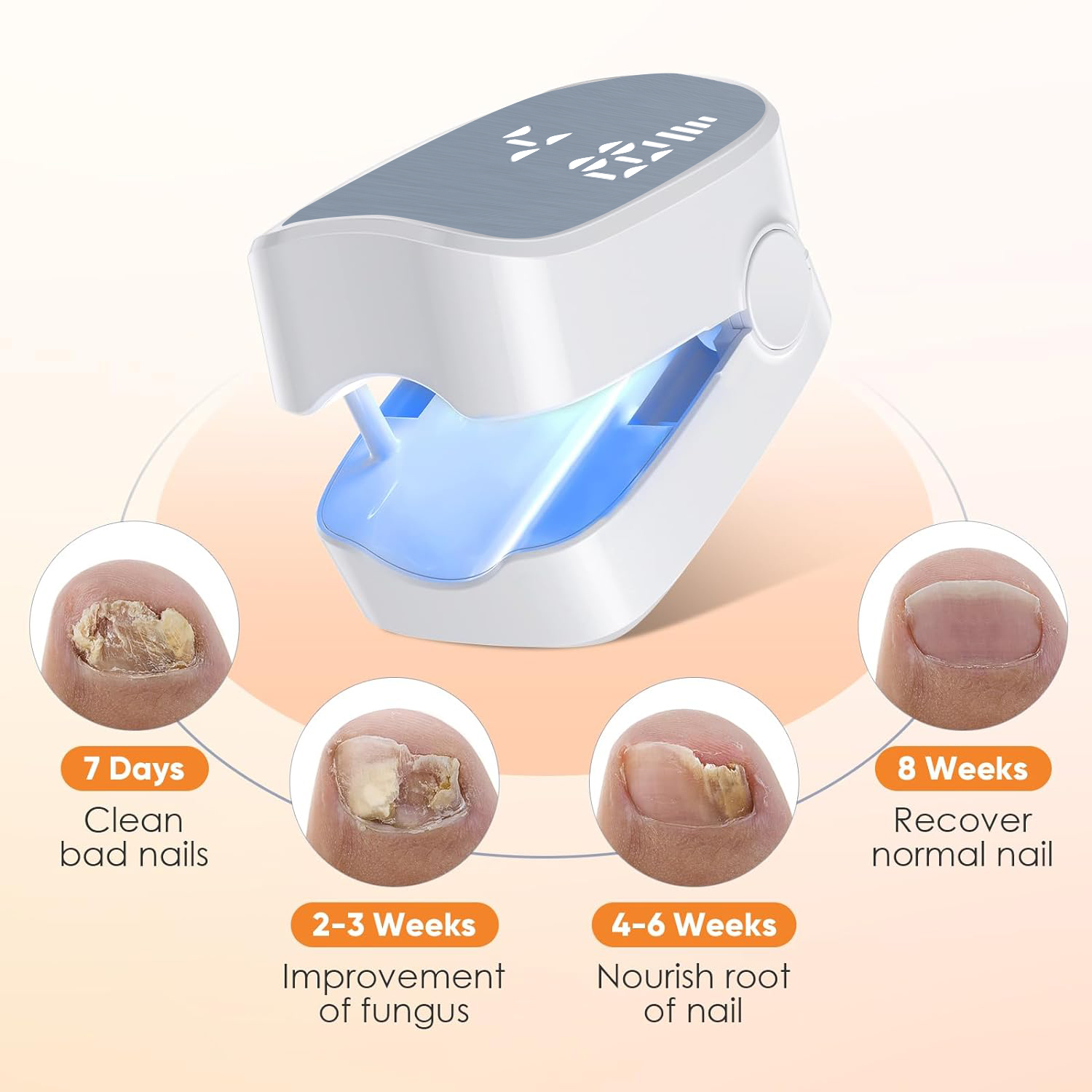 1 قطعة فعالة قابلة للشحن مزيل  - مراجعة Industrial Laser Removal وسعره